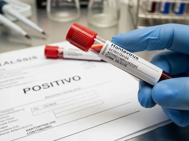 Hantavirus en Argentina: la letalidad alcanzó un récord histórico en la temporada 2025-2026 - imagen de origen