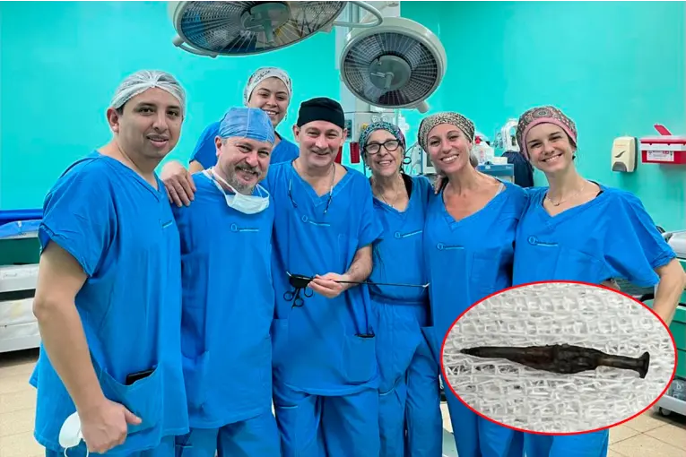 Hito en la salud pública: salvaron a un niño tras extraerle un clavo del intestino con innovadora cirugía sin cicatrices - imagen de origen