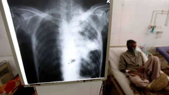 Entre Ríos, en alerta por la suba de casos de tuberculosis en 2026 - imagen de origen