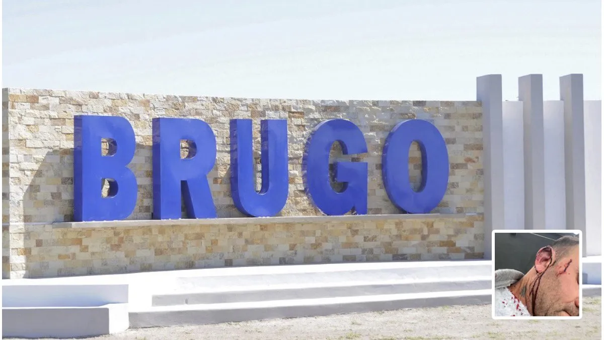 Escándalo en Pueblo Brugo: acusaciones cruzadas entre el intendente agredido y el concejal - imagen de origen