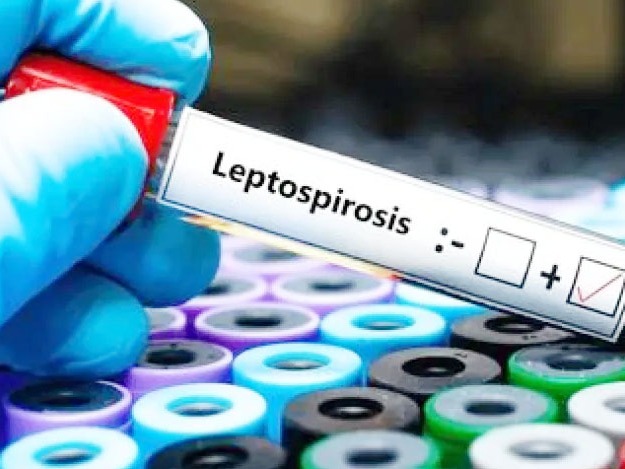 Preocupa el avance de la leptospirosis en Entre Ríos y crecen las alertas por la proliferación de roedores - imagen de origen