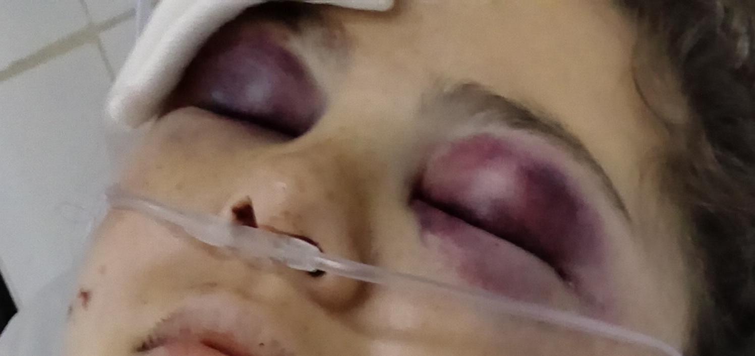 Misterio y preocupación: una joven universitaria fue hallada gravemente herida en una avenida de Concordia y buscan testigos - 7PAGINAS - imagen de origen