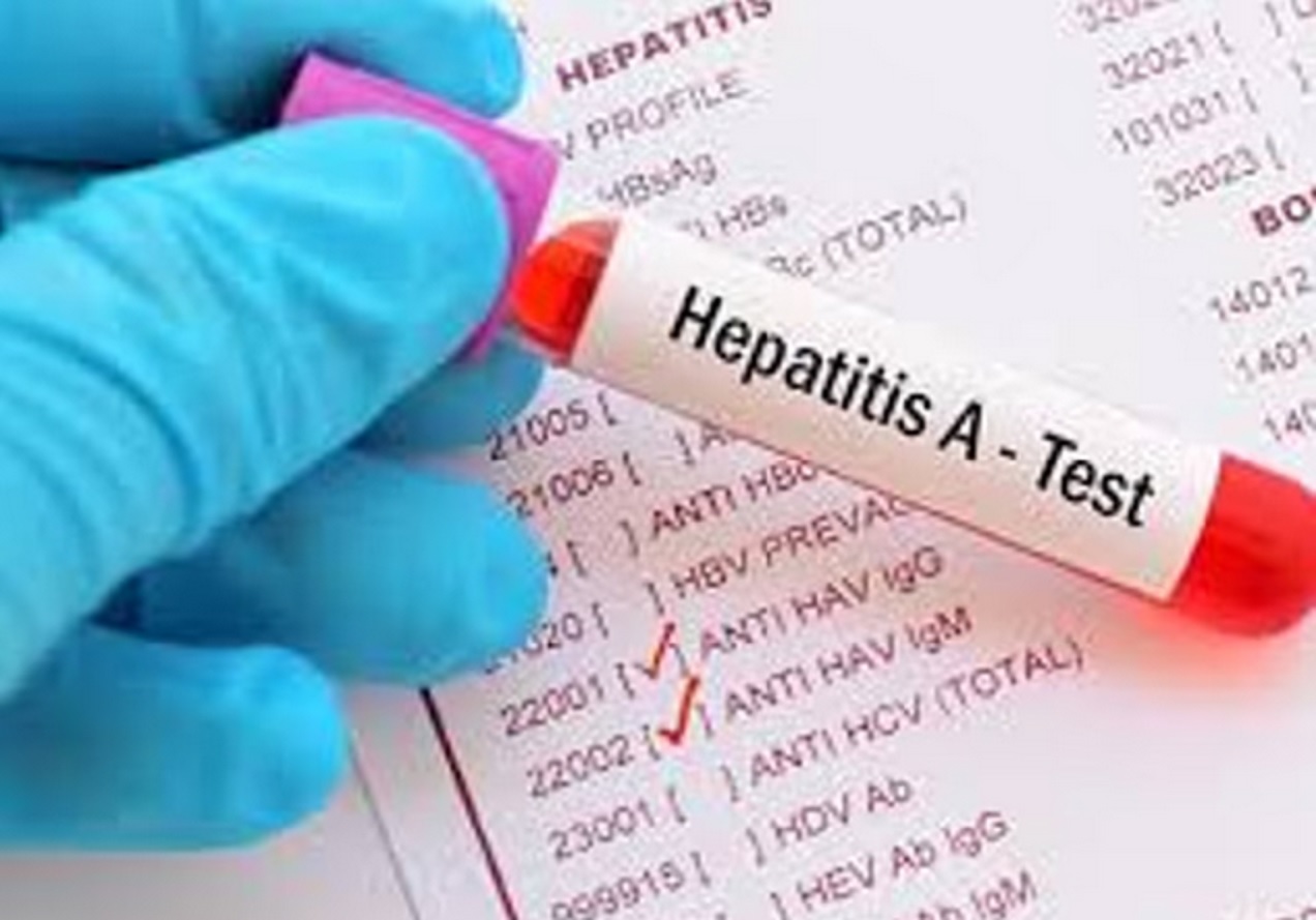 Hepatitis A: la confirmación de 34 nuevos casos pone a Argentina en zona de alerta - imagen de origen