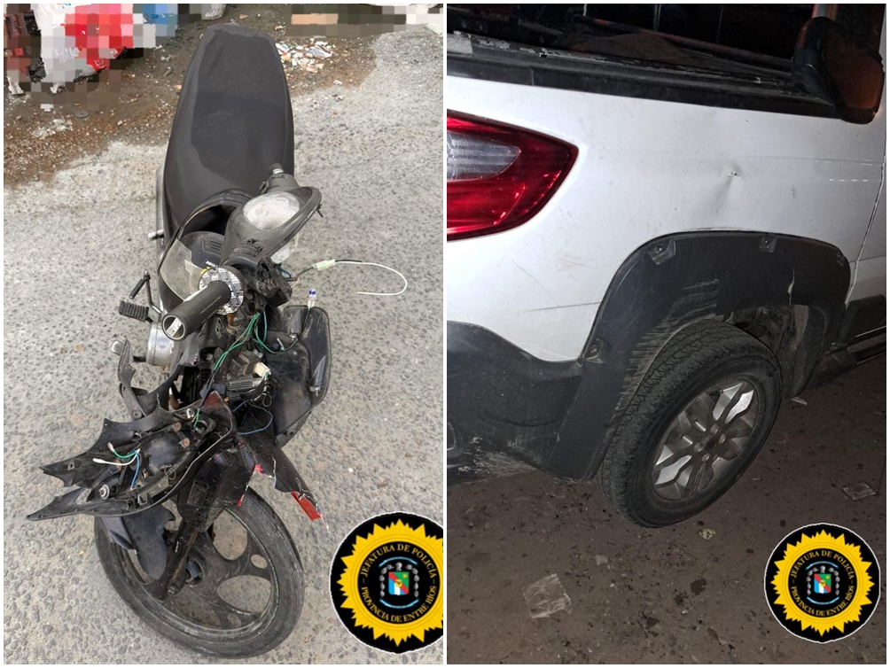 Siniestro vial en Villaguay: Un menor de 15 años sufrió fracturas tras ser colisionado por una conductora alcoholizada - 7PAGINAS - imagen de origen