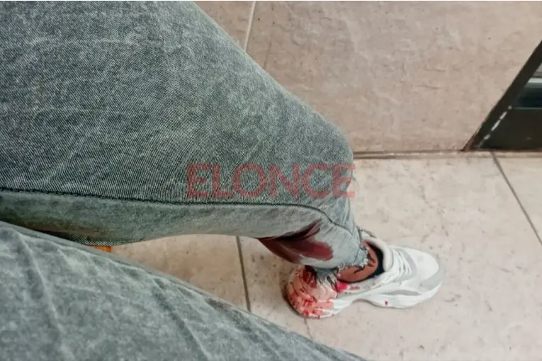 Apuñalaron a una joven en Paraná tras una pelea cerca de una escuela - Informe Digital - imagen de origen