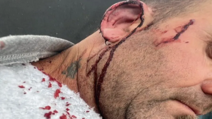 El intendente de Pueblo Brugo fue agredido por un concejal en una acalorada discusión | Análisis - imagen de origen