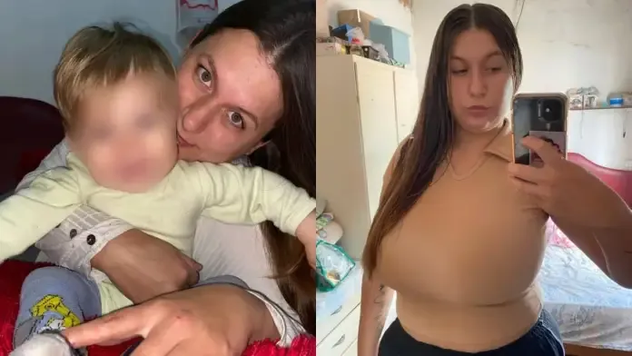 Salió de Terapia Intensiva la joven herida en una “picada” de motos - imagen de origen