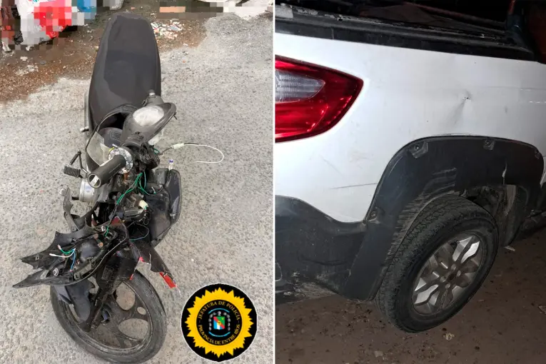 Adolescente sufrió fracturas tras chocar con una camioneta conducida por una mujer alcoholizada - imagen de origen