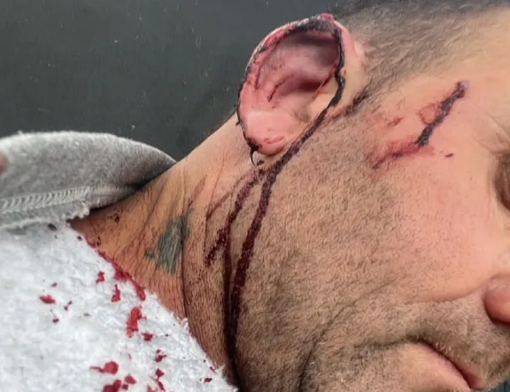 Agredieron al intendente de Pueblo Brugo en el propio palacio municipal - imagen de origen