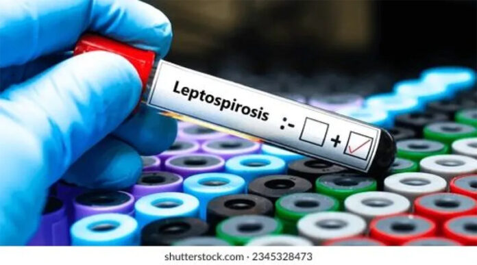 Entre Ríos acumula 15 casos de leptospirosis en lo que va del año - imagen de origen