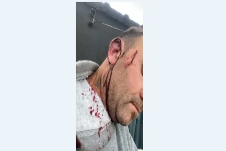 Tras una discusión agredieron a un intendente entrerriano - imagen de origen