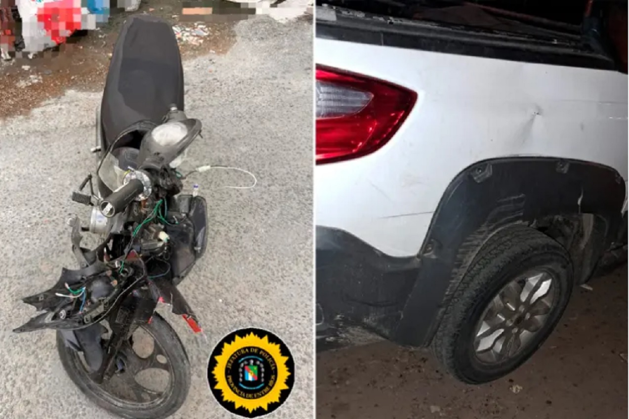 Adolescente sufrió fracturas tras chocar con una camioneta conducida por una mujer alcoholizada - imagen de origen
