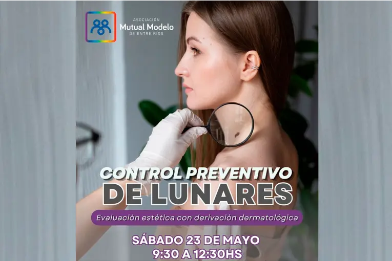 Control de lunares: Mutual Modelo impulsa una jornada preventiva por el Día del Melanoma - imagen de origen