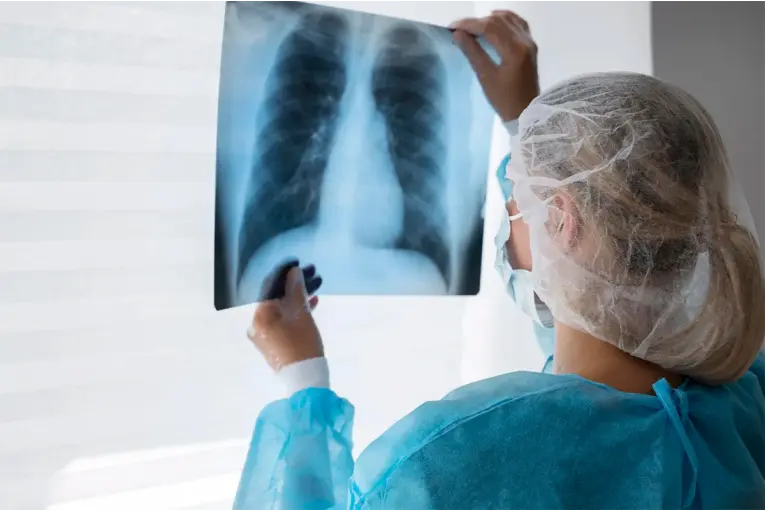 Tuberculosis: Entre Ríos registró un aumento del 38,8% en los casos detectados - imagen de origen